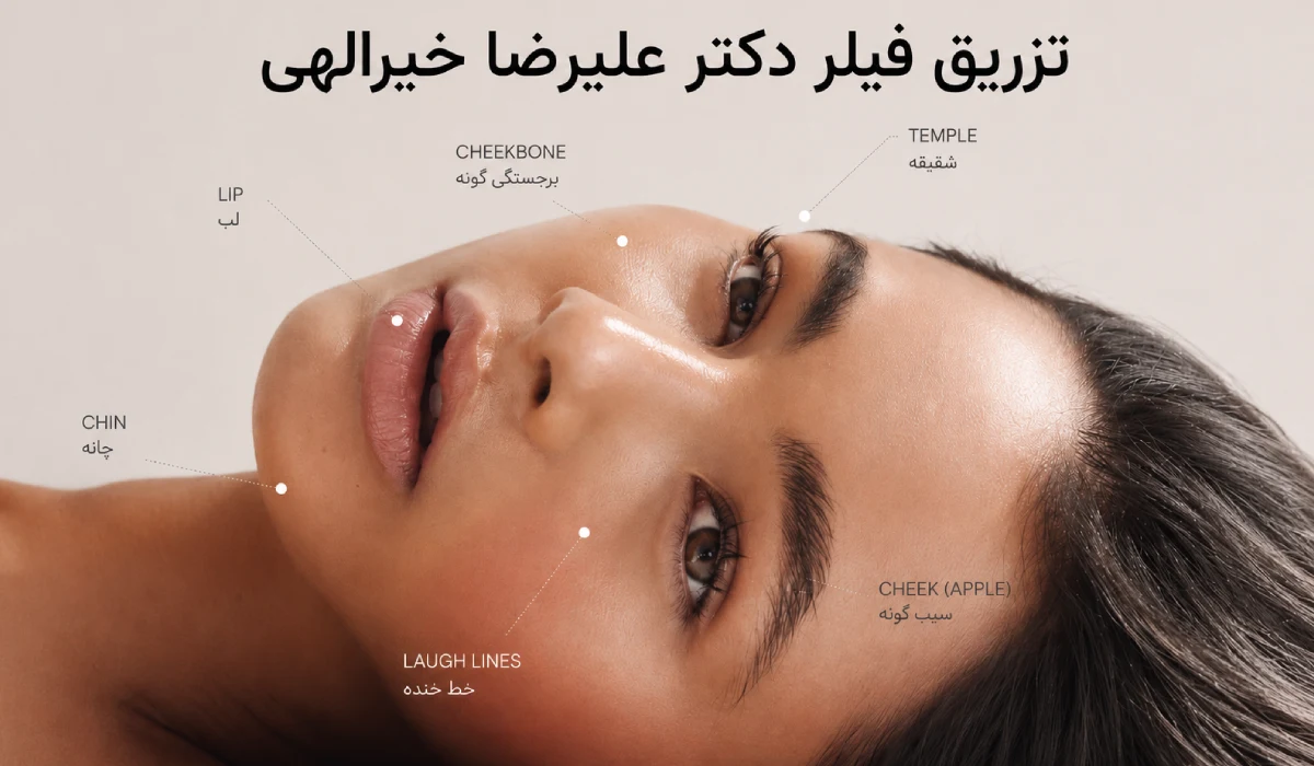 مشخص کردن نقاط تزریق فیلر صورت