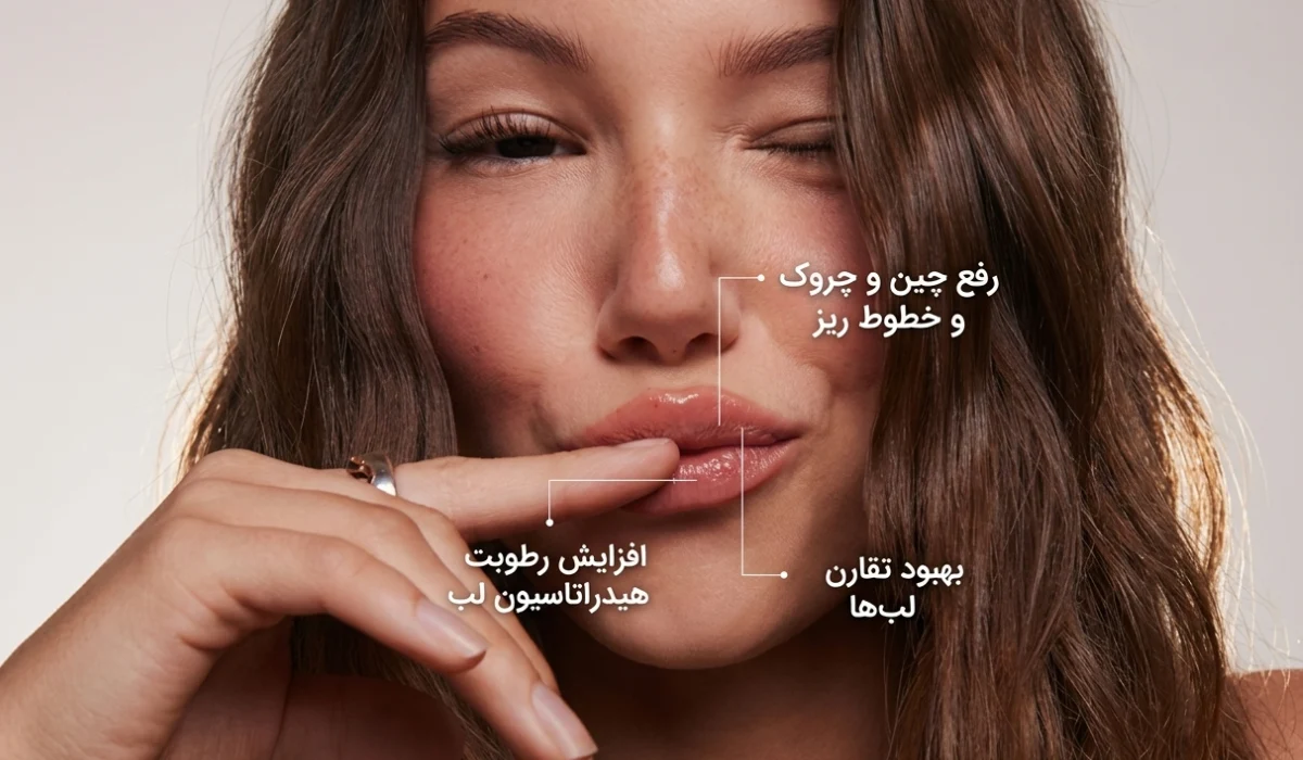 فواید تزریق فیلر لب بر روی تصویر