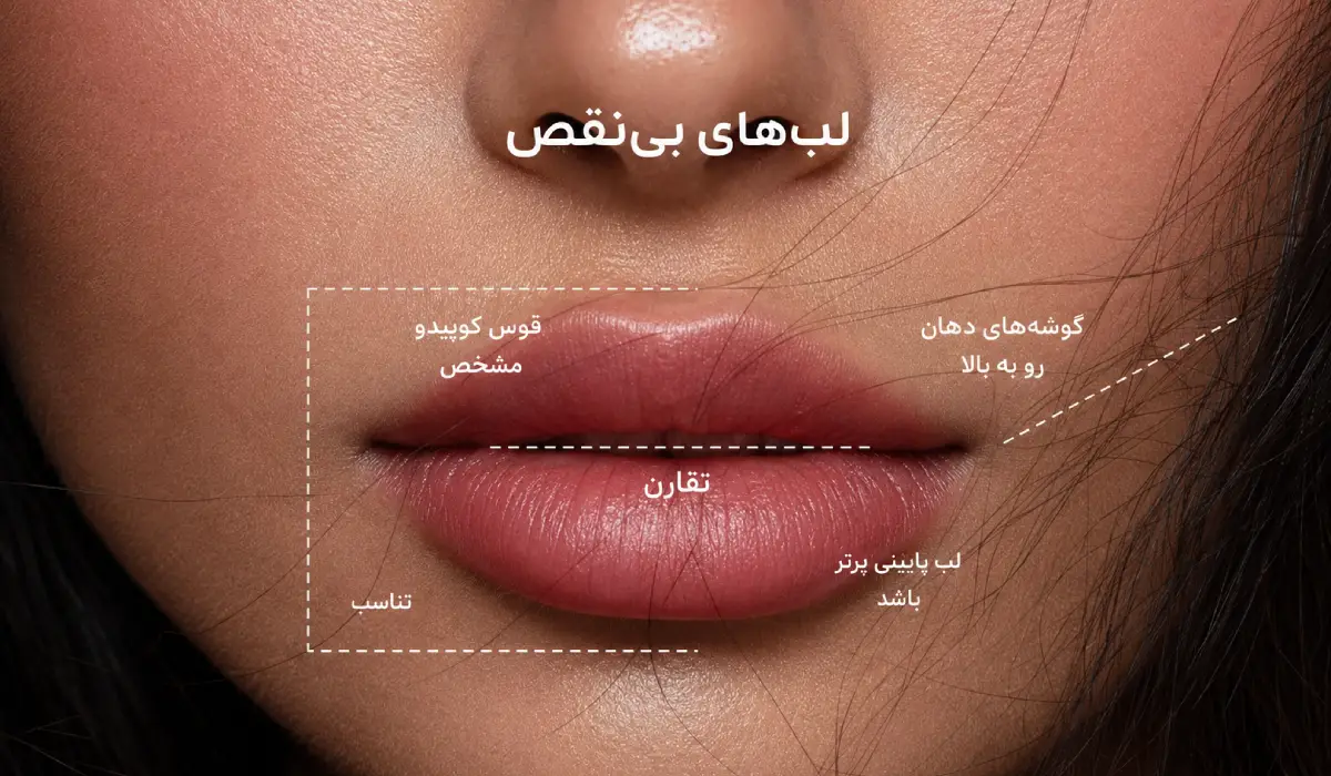 نقاط تزریق فیلر لب
