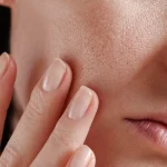 نمای نزدیک از منافذ باز پوست صورت یک خانم جوان