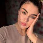 نقاط تزریق فول فیس با فیلر و مقایسه با بوتاکس