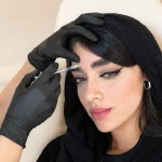 افتادگی پلک بعد از بوتاکس برای این خانم رخ داده است.