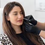 تزریق فیلر خط خنده برای دختر خانم جوان در کلینیک زیبایی
