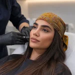 تزریق مزوژل برای روشن شدن پوست این خانم