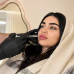 خانمی در حال تزریق ژل لب در کلینیک دکتر خیرالهی | مراقبت‌های بعد از تزریق ژل لب