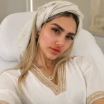 خانمی که از ورم بعد از فیلر لب خود نگران است.