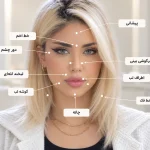 مشخص شدن نقاط تزریق بوتاکس فول فیس