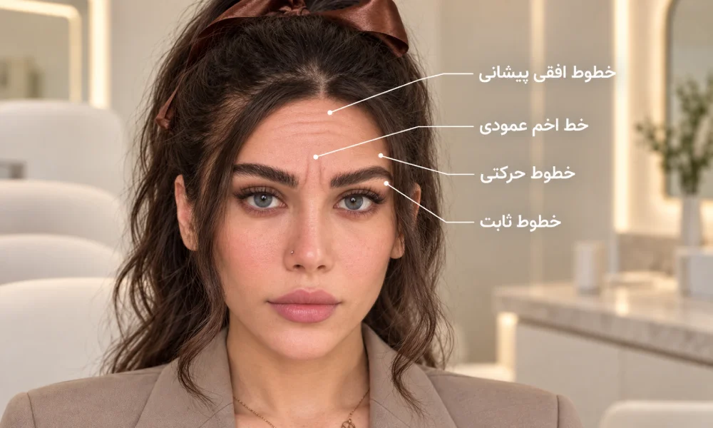 نمایش انواع خطوط پیشانی روی صورت مدل