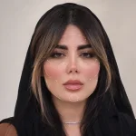نقاط تزریق فیلر فول فیس
