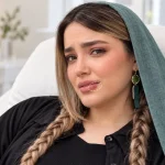 تبخال بعد از تزریق فیلر لب