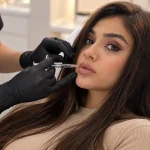 ترمیم فیلر لب خانمی جوان بعد از چند ماه