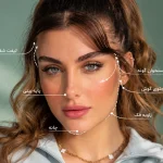 نقاط تزریق پروفایلو و تکنیک BAP