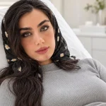 کبودی بعد از تزریق فیلر چانه
